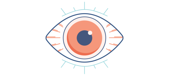 Illustration d'un œil rouge et sec